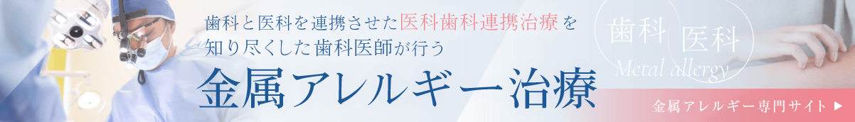 金属アレルギー専門サイトへ　歯科と医科を連携させた医科歯科連携治療を知り尽くした歯科医師が行う「金属アレルギー治療」