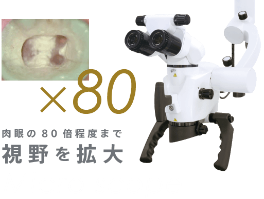 肉眼の80倍程度まで視野を拡大