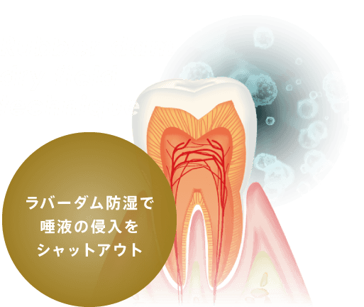 ラバーダム防湿で唾液の侵入をシャットアウト